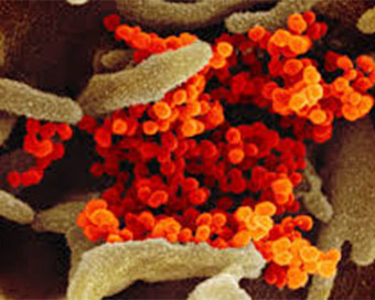 HIV virus